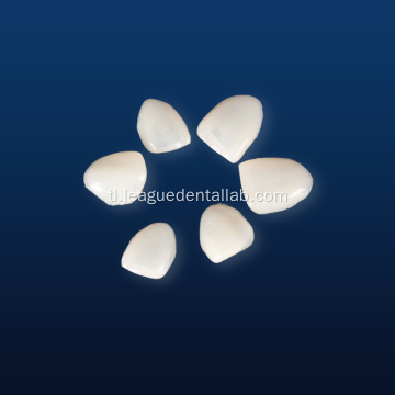 IPS Emax Dental Restorations
